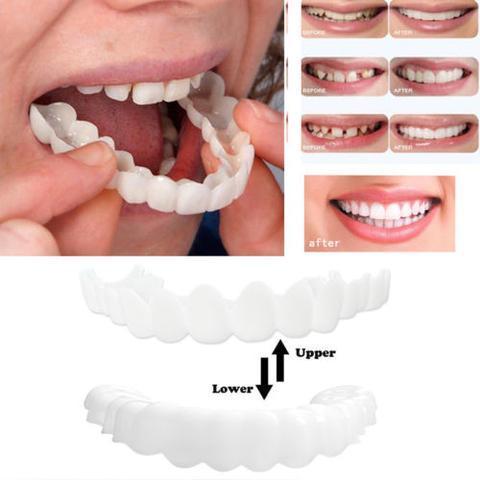 Instant Perfect Smile Clip Supérieur Et Inférieur/Encliquetable Sur Les Facettes Pour Des Dents Parfaites Comme Une Célébrité
