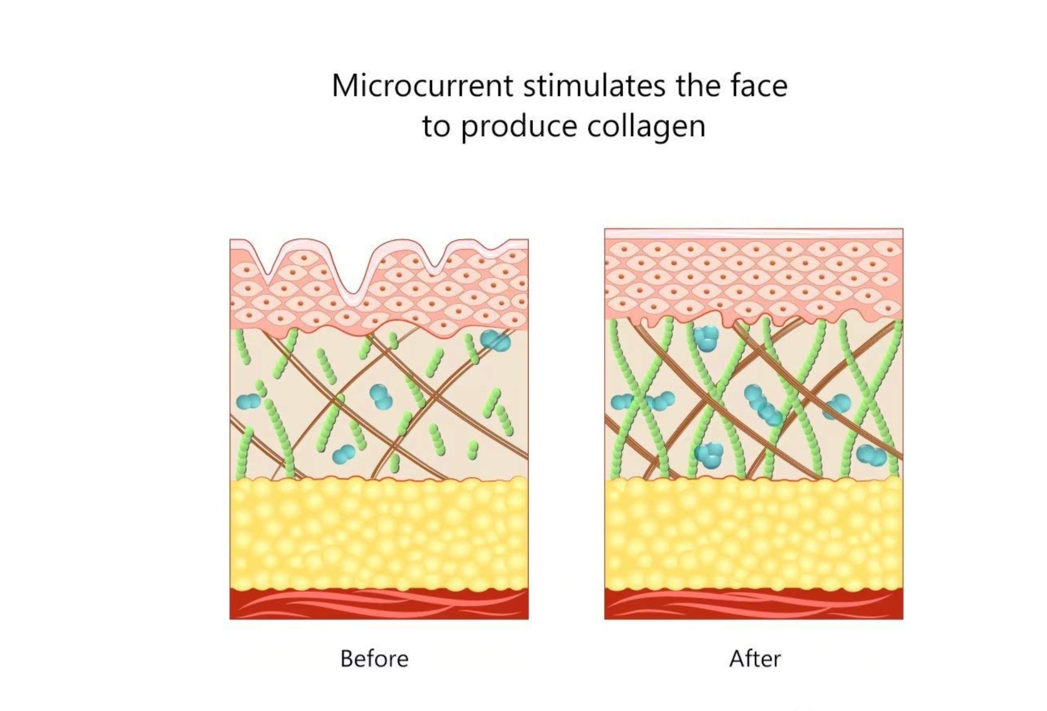 Microcurrent Face Life Machine-Anti-Âge-Raffermissement De La Peau