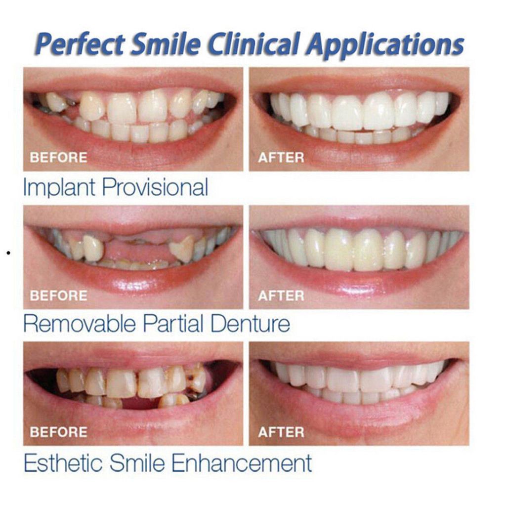 Instant Perfect Smile Clip Supérieur Et Inférieur/Encliquetable Sur Les Facettes Pour Des Dents Parfaites Comme Une Célébrité