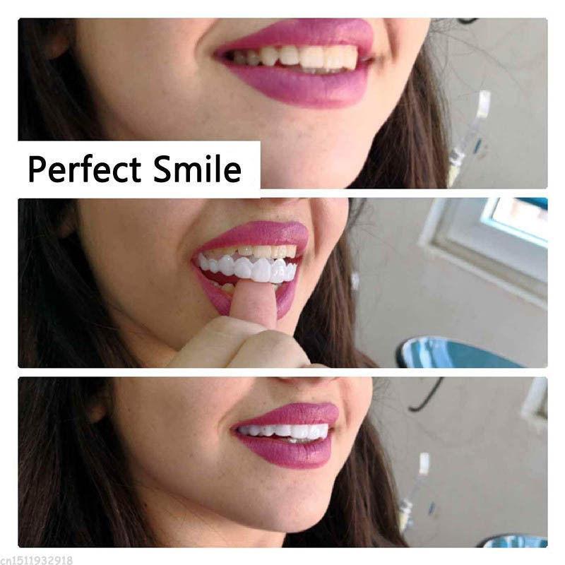 Instant Perfect Smile Clip Supérieur Et Inférieur/Encliquetable Sur Les Facettes Pour Des Dents Parfaites Comme Une Célébrité