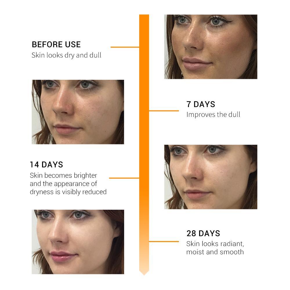 Sérum À La Vitamine C | Blanchiment Du Visage | Éclaircir La Peau | Fade Dark Spots | Enlever Les Taches De Rousseur | Dissolvant De Cercle Noir