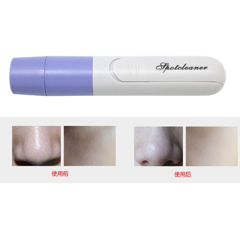 Aspirateur Blackheads