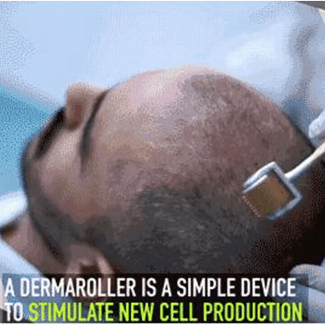 Micro Aiguille À Rouleau Dermique Pour Le Visage Et Les Cheveux