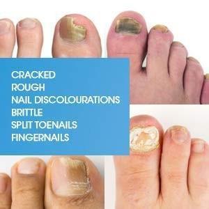 Bio-Pen Nailcare® Nail Regen