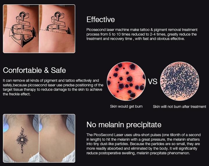 Machine D'Elimination De Tatouage Au Stylo Laser Picosecond
